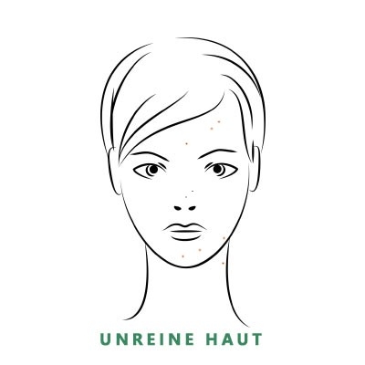 Grafik Unreine Haut